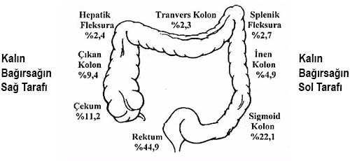 Rektum Kanserinin Bağırsak Üzerindeki Yerleşimi